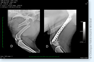 Fracture du fémur chez un chien et ostéosynthèse par plaque verrouillée.